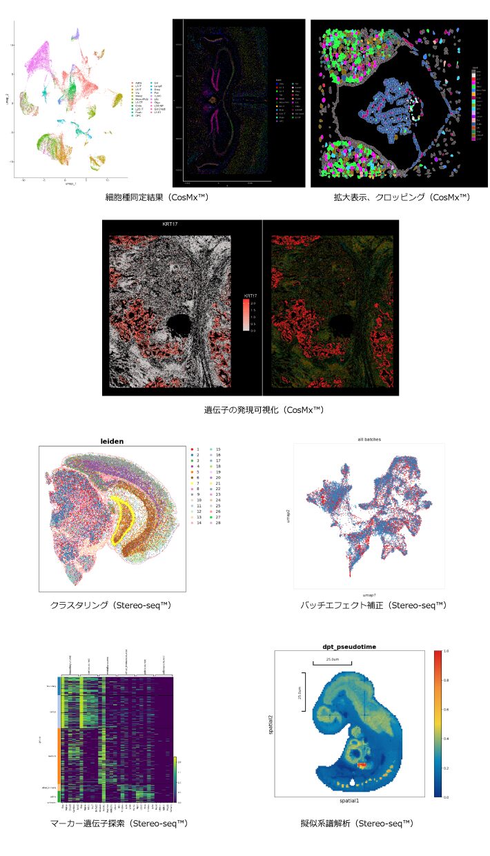 空間的遺伝子発現解析結果